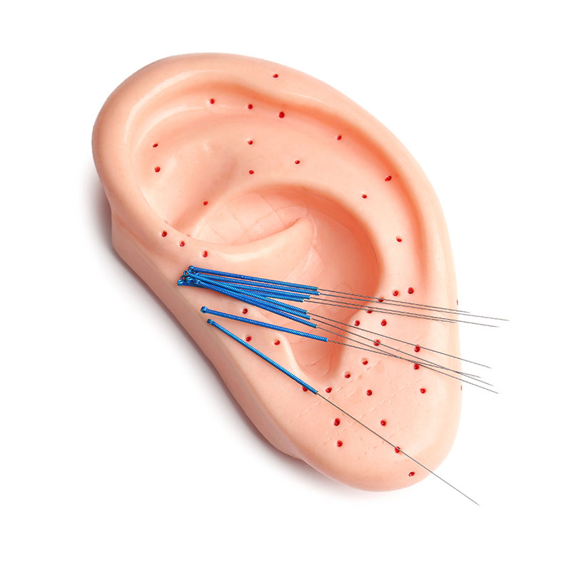 auriculopuntura4